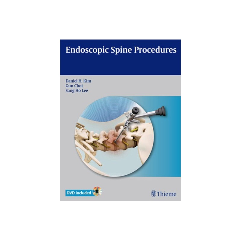 Endoscopic Spine Procedures